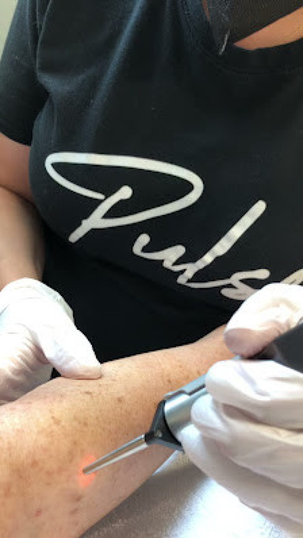 A person receiving laser treatment on their arm.